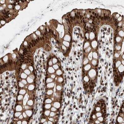 Immunohistochemistry: FAM135B Antibody [NBP1-86718]