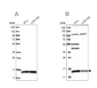 Western Blot: FAM136A Antibody [NBP1-82226]