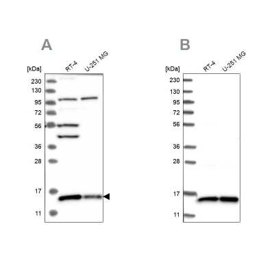 Western Blot: FAM136A Antibody [NBP1-82227]