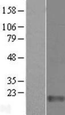 Western Blot: FAM136A Overexpression Lysate [NBL1-10477]