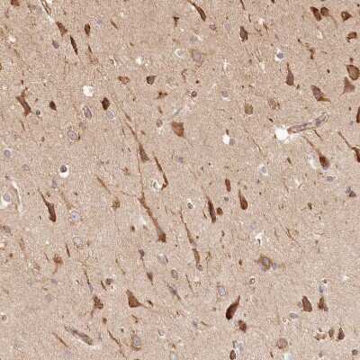 Immunohistochemistry-Paraffin: FAM13A Antibody [NBP1-88825]