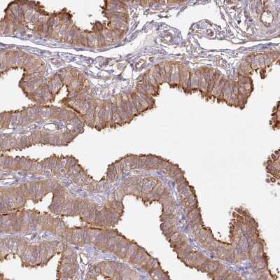 Immunohistochemistry-Paraffin: FAM13A Antibody [NBP1-88825]