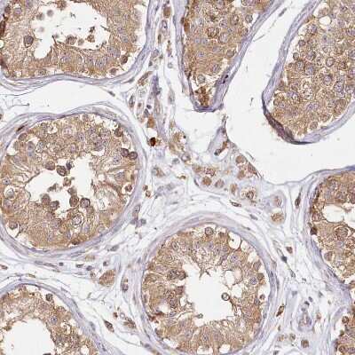 Immunohistochemistry-Paraffin: FAM13A Antibody [NBP1-88825]