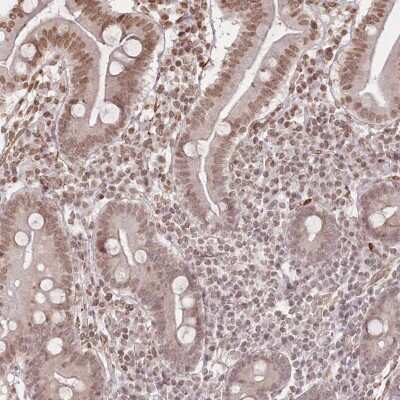 Immunohistochemistry-Paraffin: FAM13A Antibody [NBP2-38388]