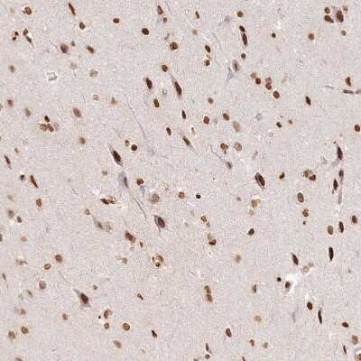 Immunohistochemistry-Paraffin: FAM13A Antibody [NBP2-38388]
