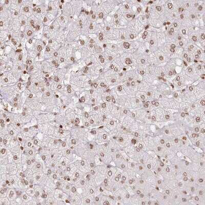 Immunohistochemistry-Paraffin: FAM13A Antibody [NBP2-38388]