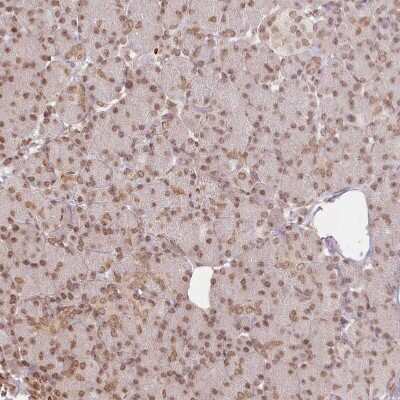 Immunohistochemistry-Paraffin: FAM13A Antibody [NBP2-38388]