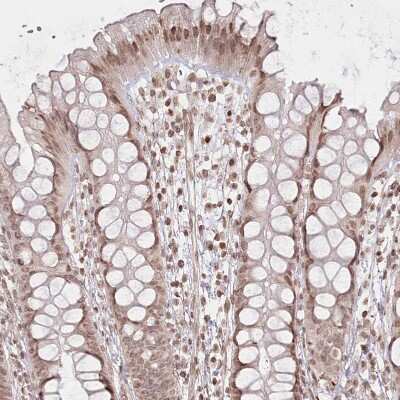 Immunohistochemistry-Paraffin: FAM13A Antibody [NBP2-38388]