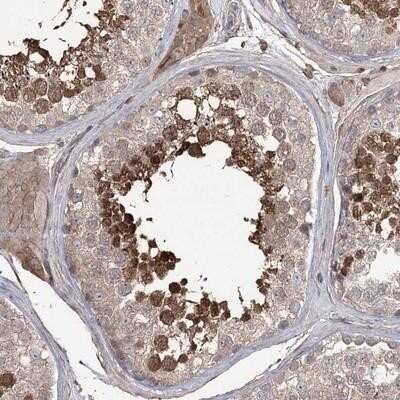 Immunohistochemistry-Paraffin: FAM13B1 Antibody [NBP1-90810]