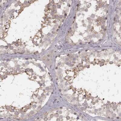 Immunohistochemistry-Paraffin: FAM13B1 Antibody [NBP2-57951]