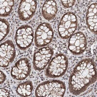 Immunohistochemistry-Paraffin: FAM13C1 Antibody [NBP1-91884]