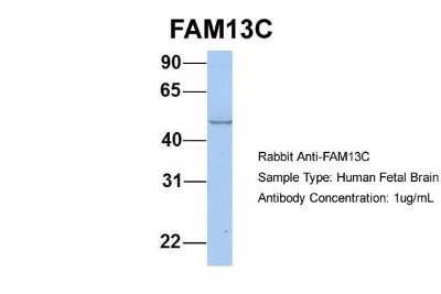 Western Blot: FAM13C1 Antibody [NBP1-56524]