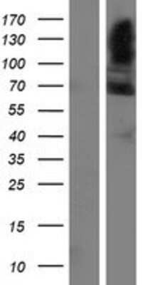 Western Blot: FAM13C1 Overexpression Lysate [NBP2-04685]