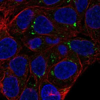 Immunocytochemistry/ Immunofluorescence: FAM149A Antibody [NBP2-68657]