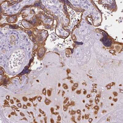 Immunohistochemistry: FAM149A Antibody [NBP2-30831]