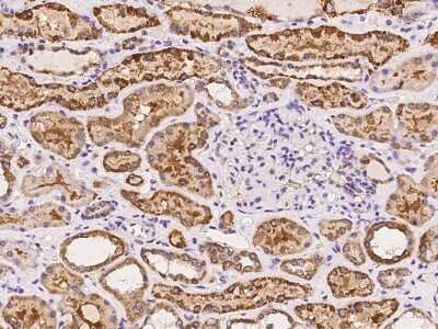 Immunohistochemistry-Paraffin: FAM149A Antibody [NBP2-98064]