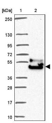 Western Blot: FAM149A Antibody [NBP2-30831]