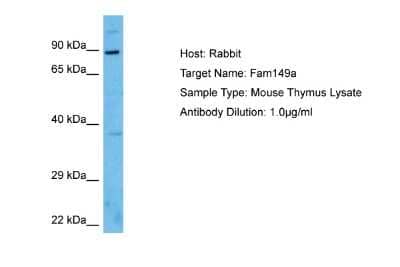 Western Blot: FAM149A Antibody [NBP2-84889]