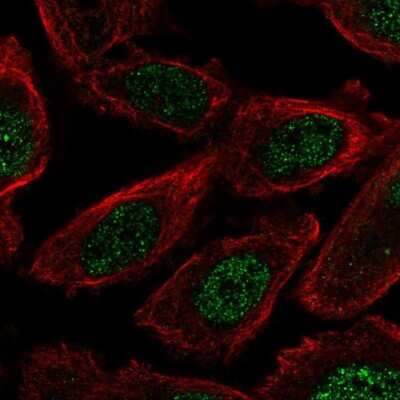 Immunocytochemistry/ Immunofluorescence: FAM149B1 Antibody [NBP2-13982]