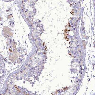 Immunohistochemistry-Paraffin: FAM149B1 Antibody [NBP1-81452]