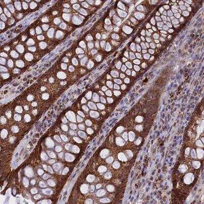 Immunohistochemistry: FAM149B1 Antibody [NBP2-13982]