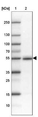 Western Blot: FAM149B1 Antibody [NBP1-81452]