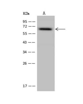 Western Blot: FAM149B1 Antibody [NBP3-06311]