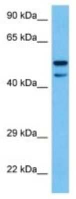 Western Blot: FAM149B1 Antibody [NBP3-10858]