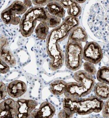 Immunohistochemistry-Paraffin: FAM151A Antibody [NBP2-13983]
