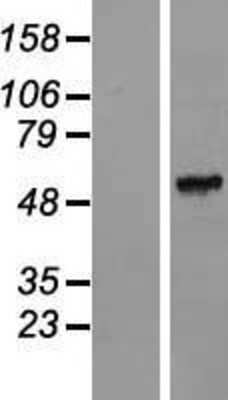 Western Blot: FAM151A Overexpression Lysate [NBL1-10482]