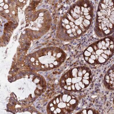 Immunohistochemistry-Paraffin: FAM151B Antibody [NBP1-90647]