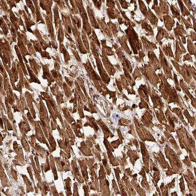 Immunohistochemistry: FAM153A Antibody [NBP2-46677]