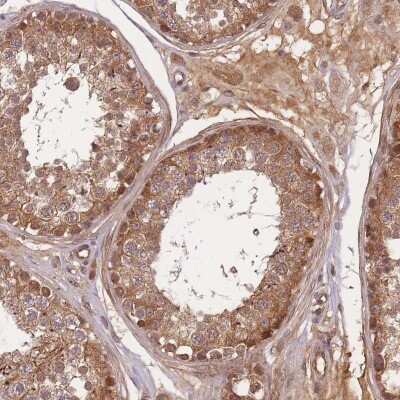 Immunohistochemistry: FAM153A Antibody [NBP2-46698]