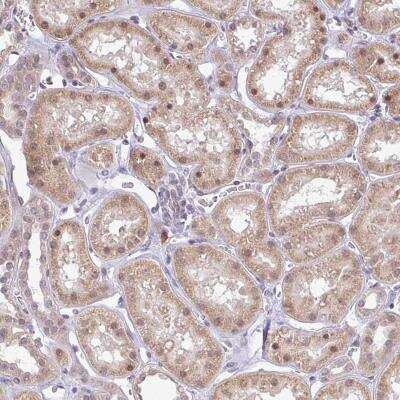 Immunohistochemistry: FAM153A Antibody [NBP2-46802]