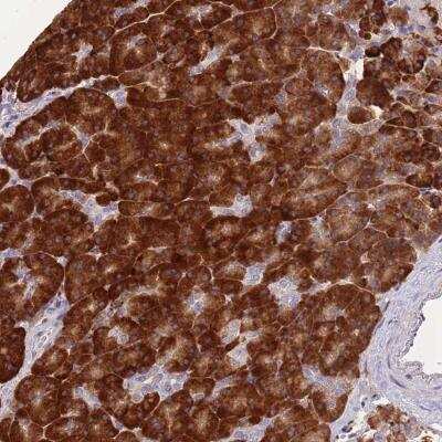 Immunohistochemistry: FAM153B Antibody [NBP2-46725]