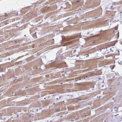 Immunohistochemistry: FAM153B Antibody [NBP2-46825]