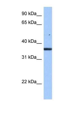 Western Blot: FAM153B Antibody [NBP1-79473]