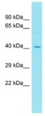 Western Blot: FAM153B Antibody [NBP3-10771]