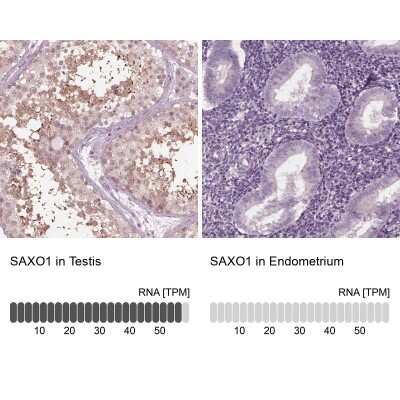 Immunohistochemistry-Paraffin: FAM154A Antibody [NBP1-86710]