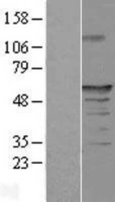 Western Blot: FAM154A Overexpression Lysate [NBL1-10485]