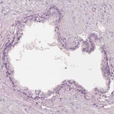 Immunohistochemistry-Paraffin: FAM154B Antibody [NBP1-90521]