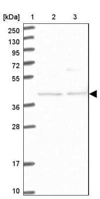 Western Blot: FAM154B Antibody [NBP1-90520]