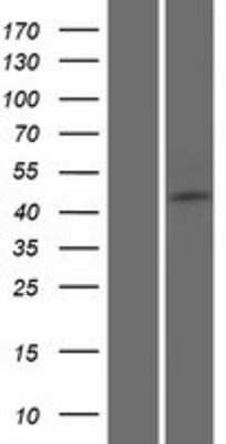 Western Blot: FAM154B Overexpression Lysate [NBP2-08803]