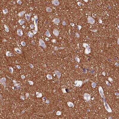 Immunohistochemistry-Paraffin: FAM155A Antibody [NBP1-90982]