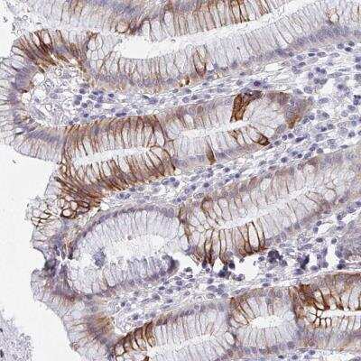 Immunohistochemistry: FAM156A Antibody [NBP2-46837]