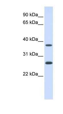 Western Blot: FAM156A Antibody [NBP1-80458]