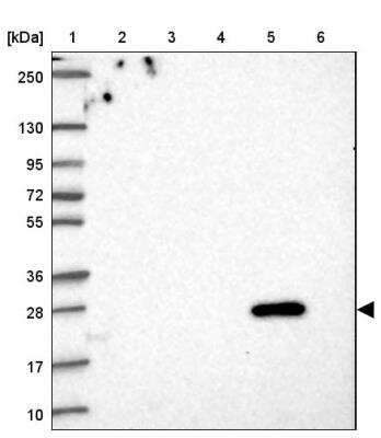 Western Blot: FAM156A Antibody [NBP2-46836]