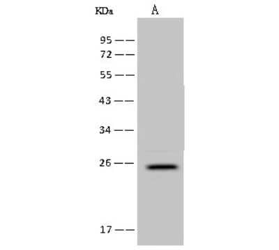 Western Blot: FAM156A Antibody [NBP2-97746]