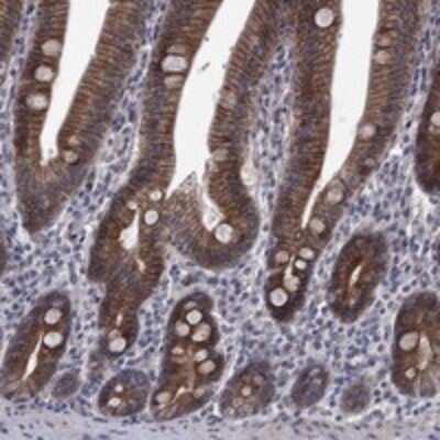 Immunohistochemistry-Paraffin: FAM158A Antibody [NBP3-17586]