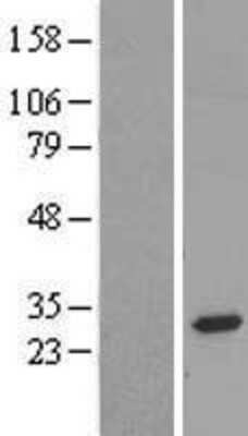 Western Blot: FAM158A Overexpression Lysate [NBL1-10487]